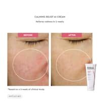 Physiogel Irritated Skin Calming Relief A.I. Cream 50ml - image 2