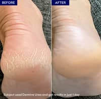 Jenpharm Dermive Urea Moisturizer For Eczema 350ml - image 3