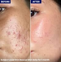 Jenpharm Skin Rescue Mist 100ml - image 4