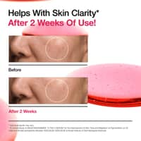 Anua Niacinamide 10%+TXA 4% Serum 30ml - image 4