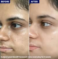 Jenpharm Maxdif Facewash 100ml - image 4