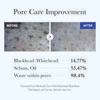 Medicube Zero Pore Blackhead Mud Mask 100g - image 4