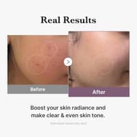 Medicube Age-R Glutathione Glow Toner 140ml - image 5