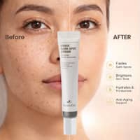 GoodnDoc Erase Dark Spot Cream 20ml*2ea