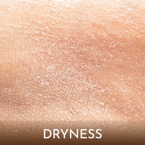 Dryness