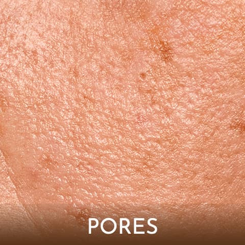 Pores